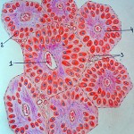 Амілоїдоз печінки