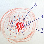 Актиномыкозна гранульома_NEW